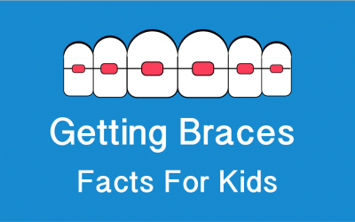 (Infographic) Getting Braces: Facts For Kids