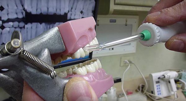 How to use Waterpik: dentists recommendation - Alex's Oral Health